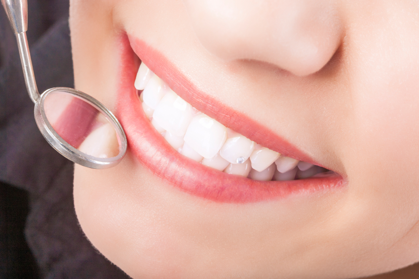 What Are Pit And Fissure Sealants?